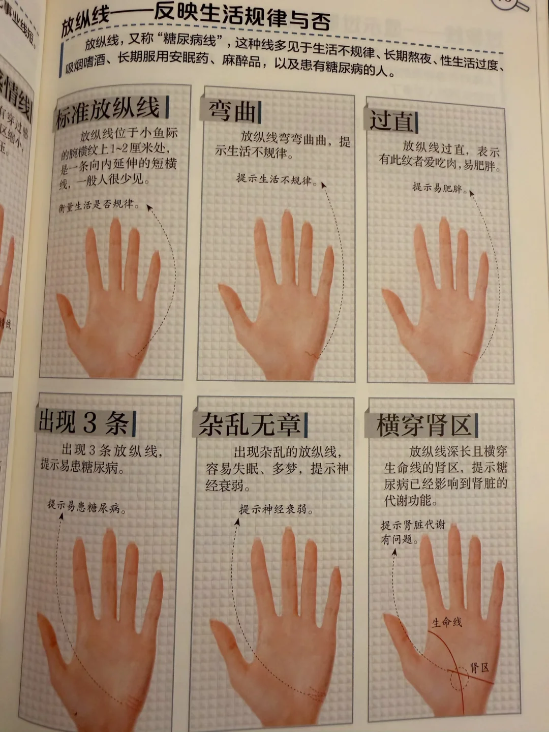 放纵线，反映生活规律与否