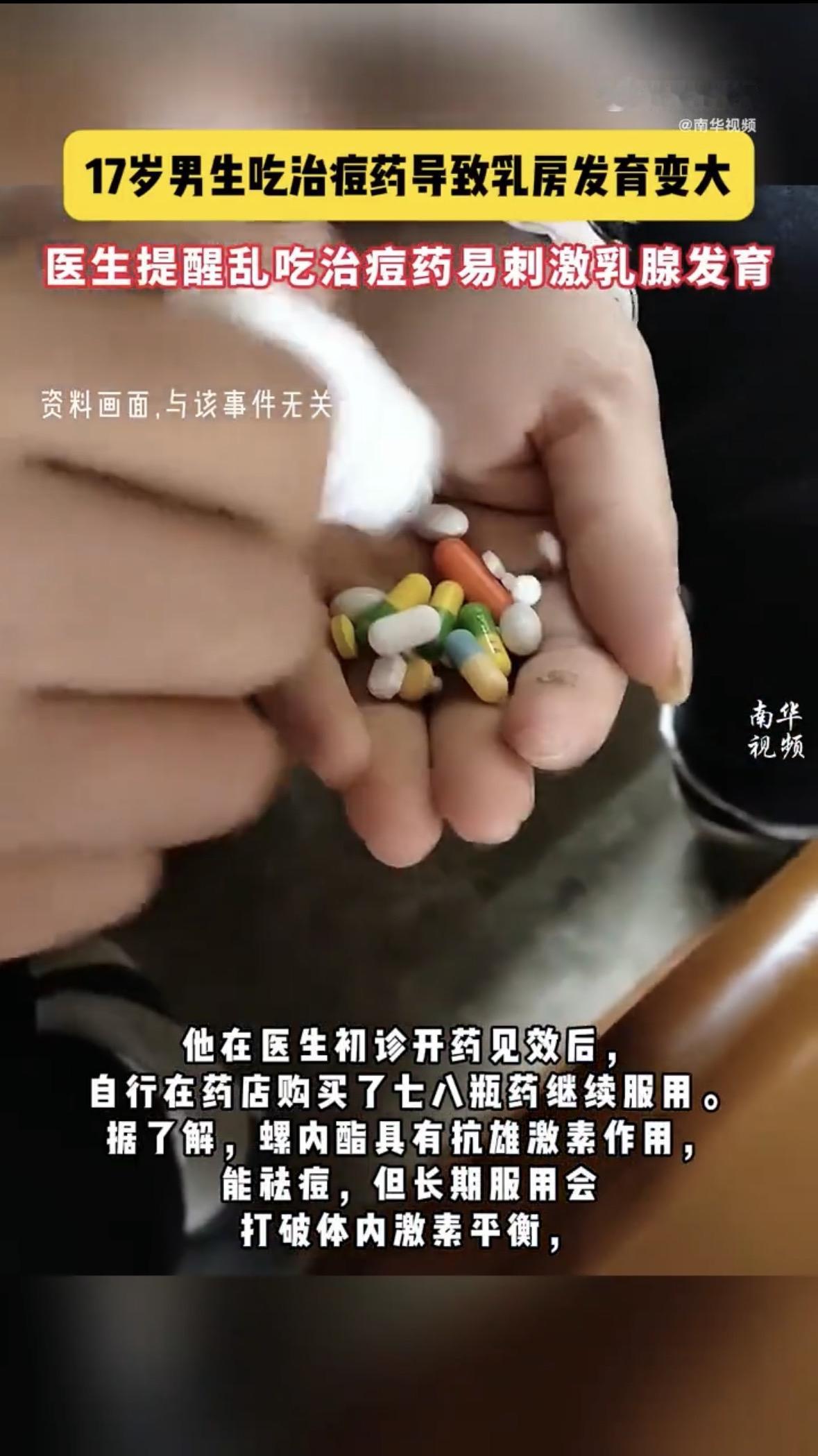 一个17岁的大小伙子，治痘痘居然把胸给治大了！不是玩笑，杭州一个高中生就摊上了这