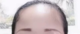 额头比例过大，眉毛都是纹的，这感情基本没戏，脾气还臭硬。 