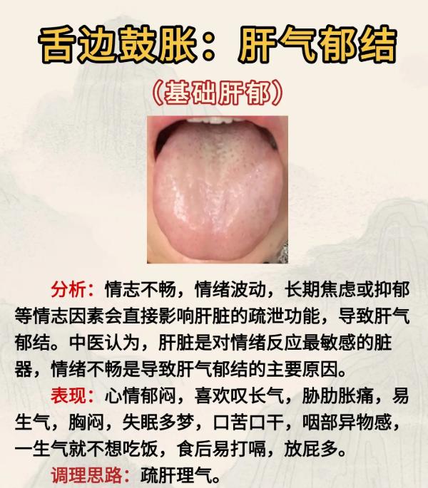 5 种肝郁舌象，对照自查肝脏状态