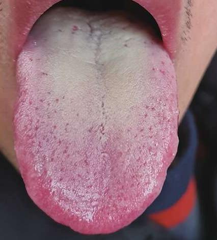 就这舌象，看第一眼我就知道你那方面不行！

为什么那么肯定？因为你舌头都告诉我了