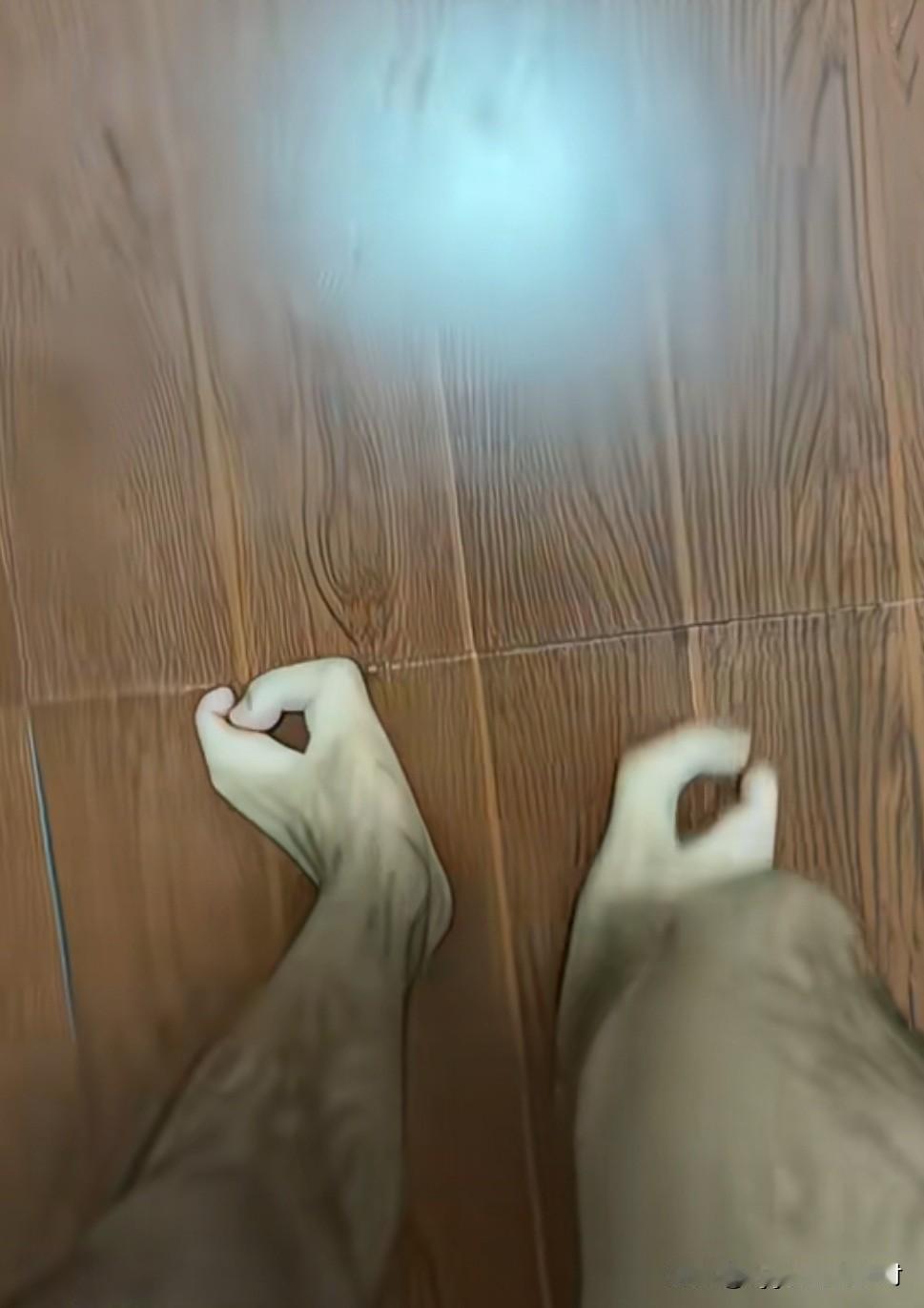 男子患上了，罕见的疾病“龙虾脚”，这还是我有生以来，第一次看到这样的脚型！

它