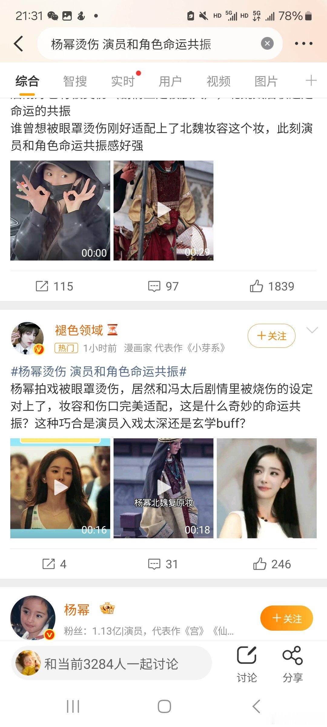 杨幂：烫伤快痊愈，出土修复中，我总结这件事就是冯太后刚好也有被烫伤（剧情上是被放