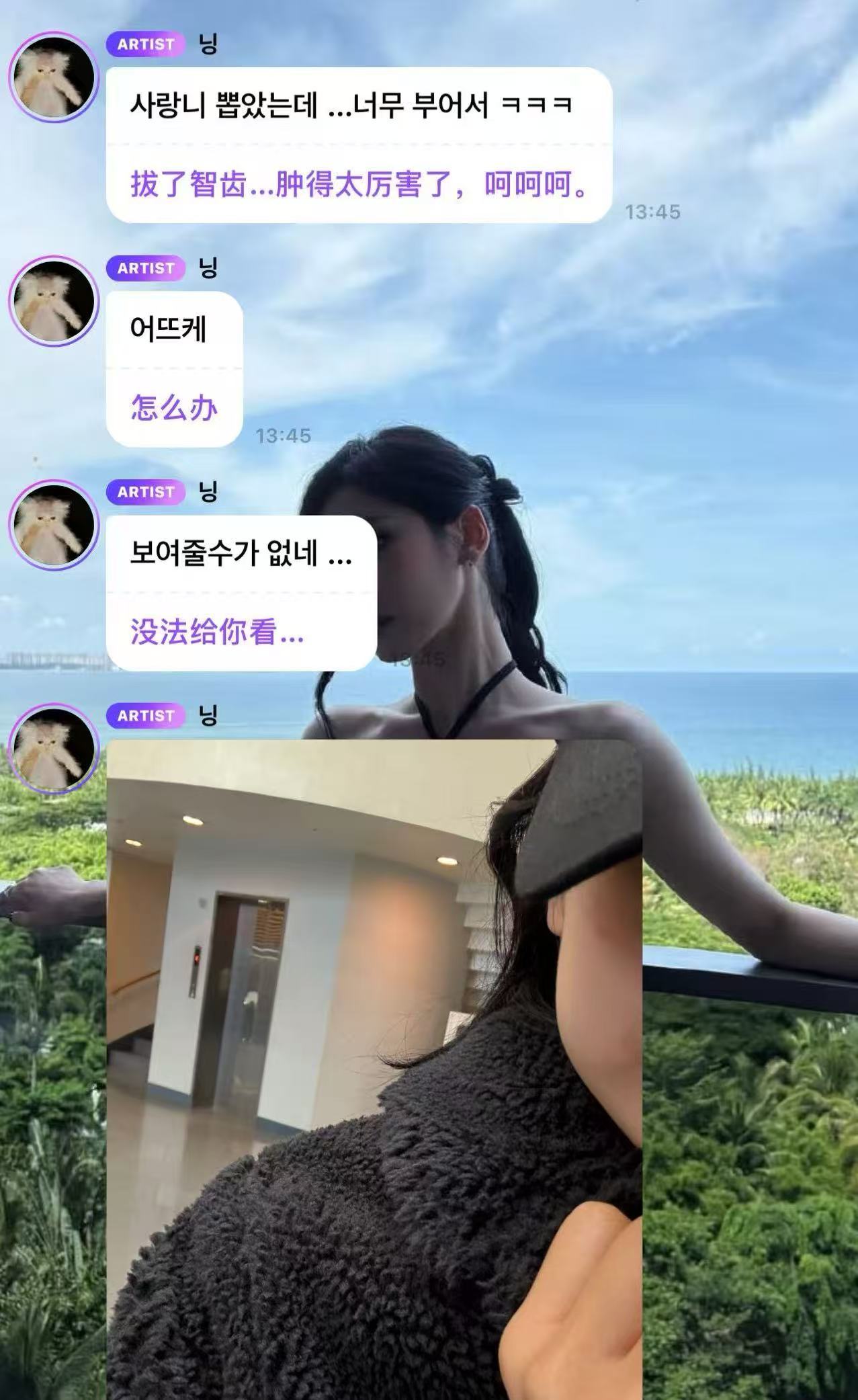 拔完智齿肿成蜜蜂小狗的宁宁🥹宁艺卓拔智齿宁艺卓肿成蜜蜂小狗 ​​​