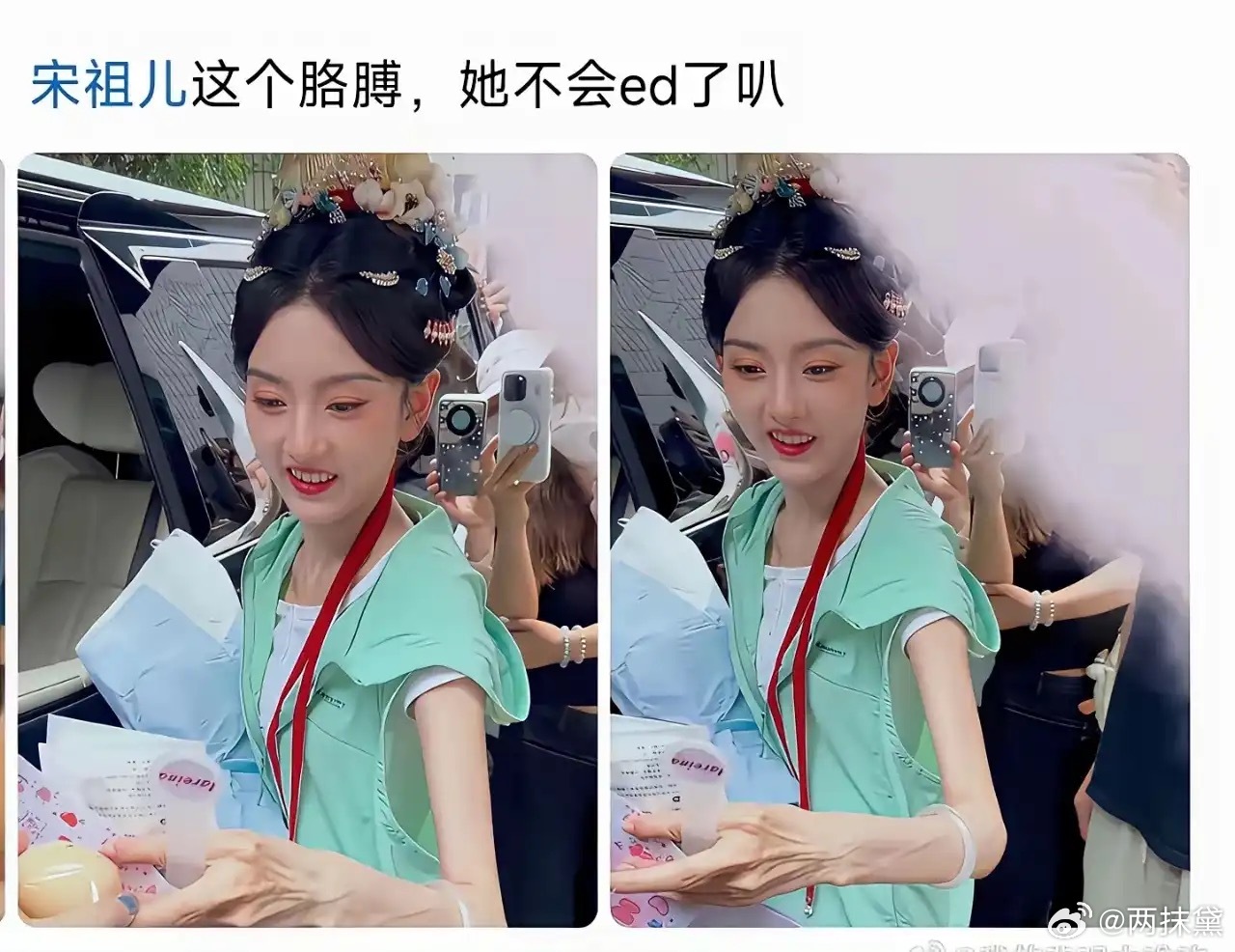 宋祖儿镯子都滑到大臂了 她真不饿吗 