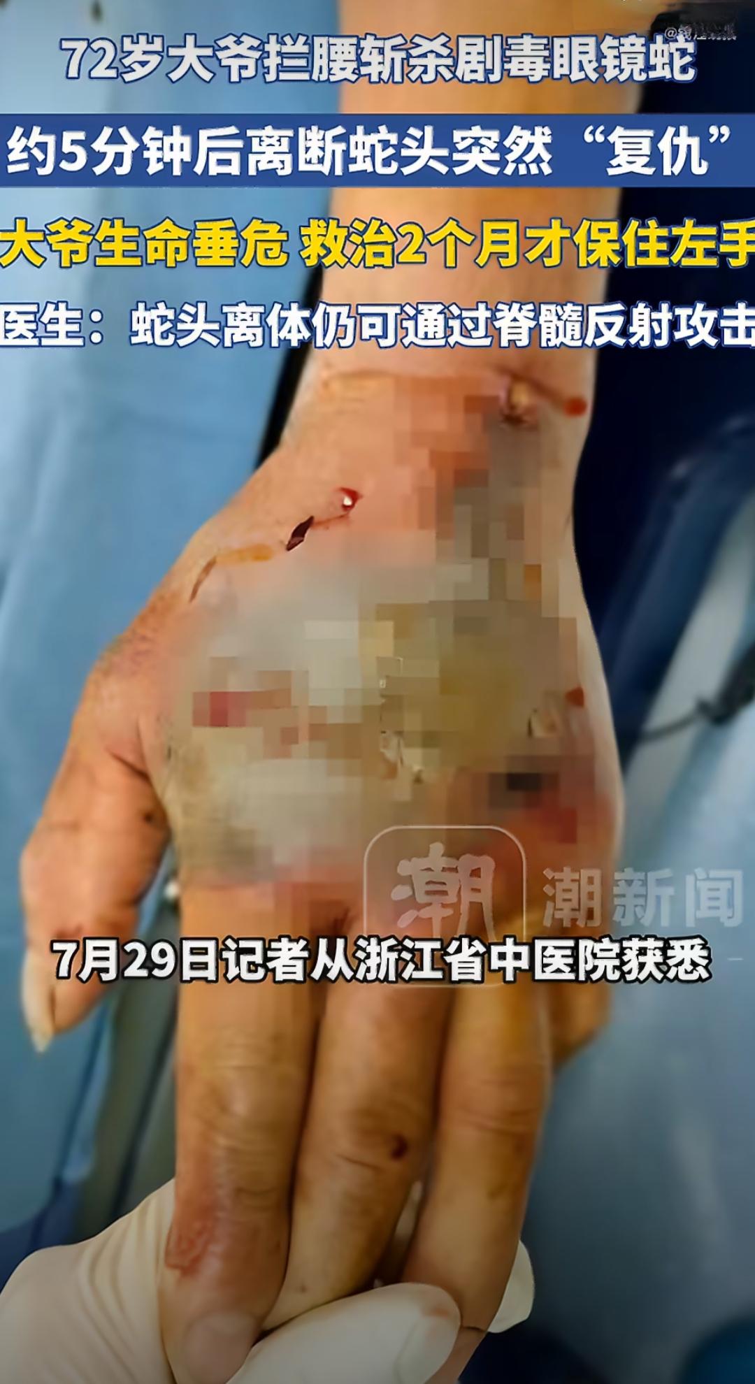 浙江诸暨的张大爷已经七十二岁了，平日里喜欢到野外河边钓鱼，那天他选了一处人少清静