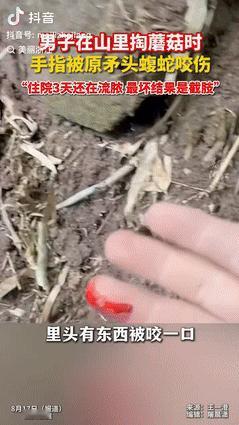 “悲剧还是发生了！”四川自贡，一男子在山里掏蘑菇时，手刚伸进去就被原矛头蝮蛇咬伤