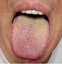 湿热困扰？男人的一生之敌，中医妙招，告别潮湿困扰！
 
有朋友啊反映自己不持久，