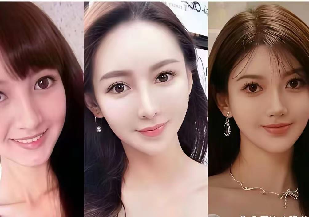 不懂就问，她植发了没？ 