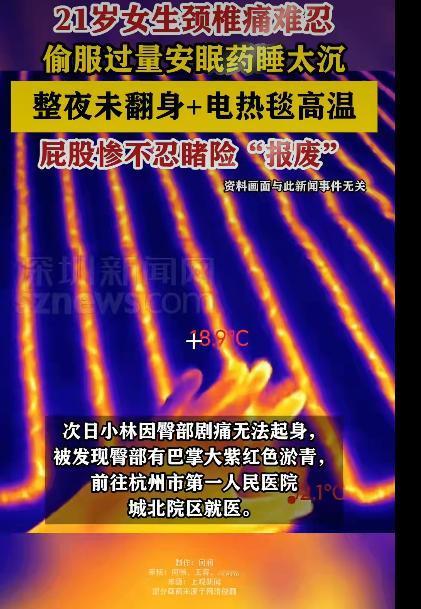 一位21岁的女生小林，因为整夜开着电热毯睡觉，醒来时发现屁股上出现巴掌大的紫红色