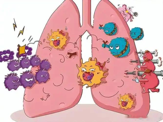 肺癌成中国女性第一大癌症健闻登顶计划 肺癌，已经悄悄成为威胁中国女性健康的“头号