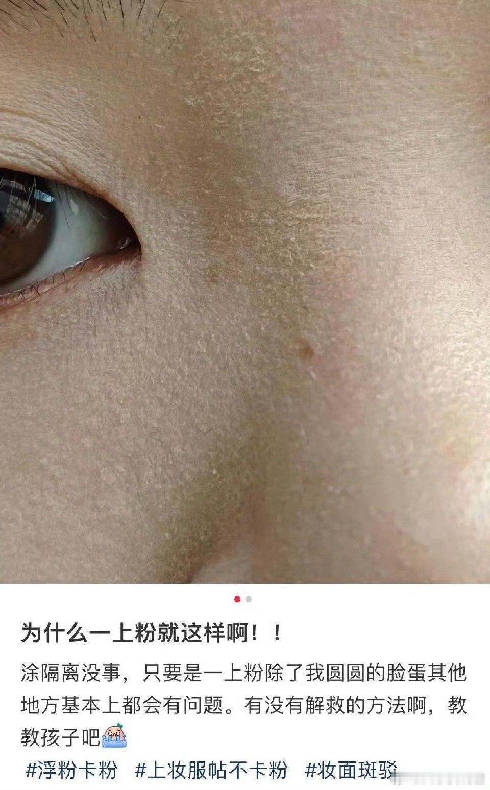 为什么一上脸就这样？ 