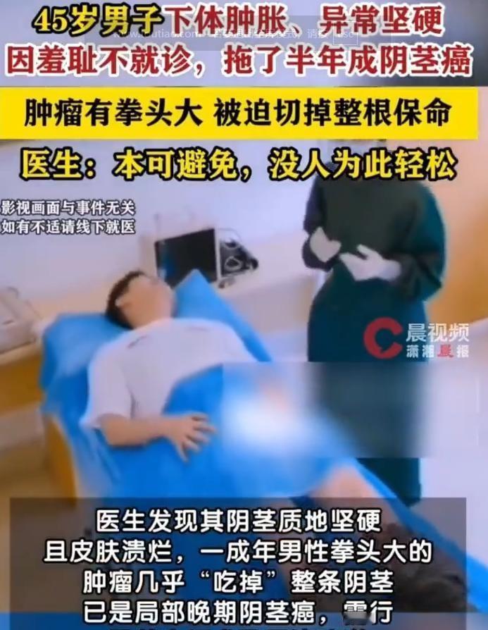 悲剧终究还是上演！据8月27日哈尔滨日报报道，浙江杭州一名45岁男子，因私密部位