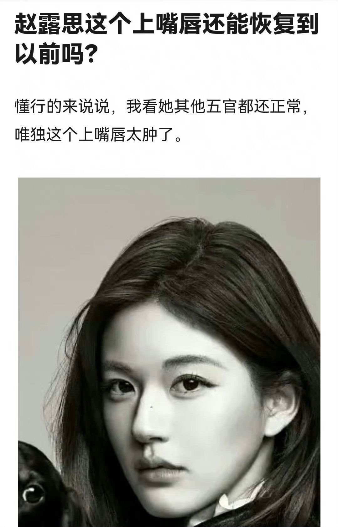 网友热议：赵露思的上嘴唇和以前是不是不太一样了？这是怎么了？ ​​​