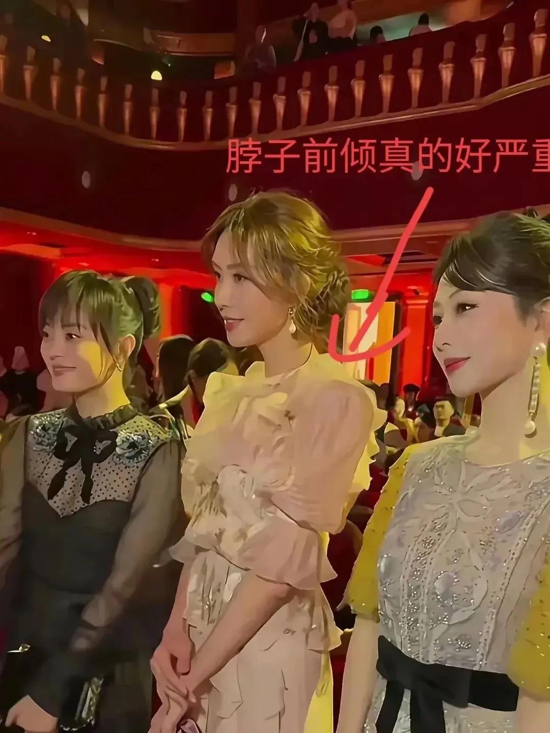林志玲嫁给黑泽良平6年后，整个人“倭化”，体态畏畏缩缩，被爆膝盖有伤，网友调侃：