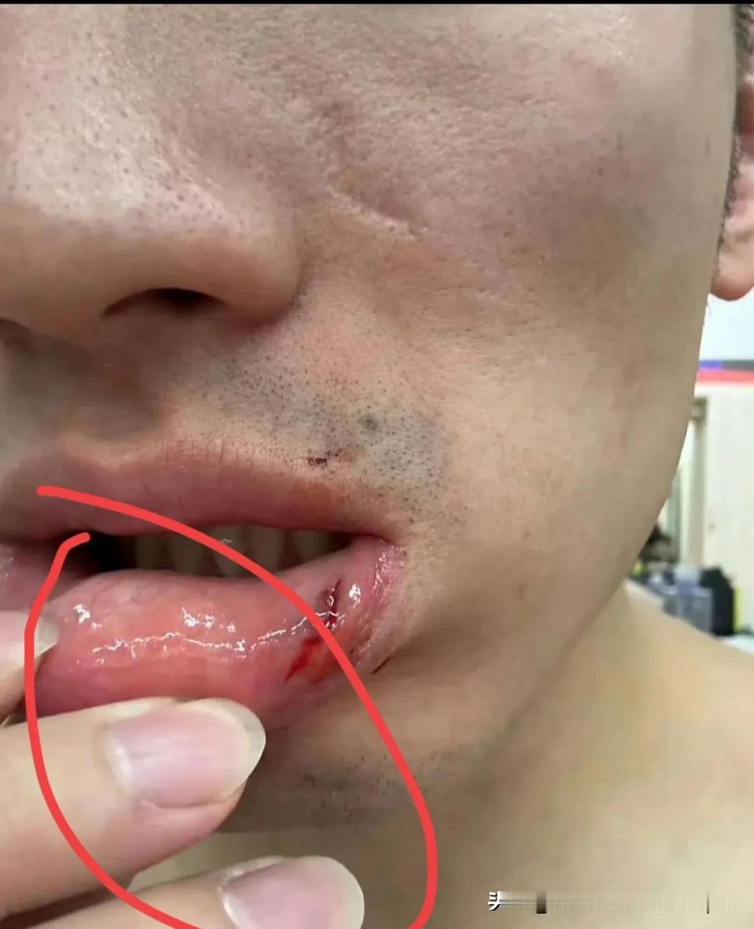 于德豪赛后晒图，手指甲也太长，这要是在场上划伤赵继伟和福格怎么办！赶快修剪一下，