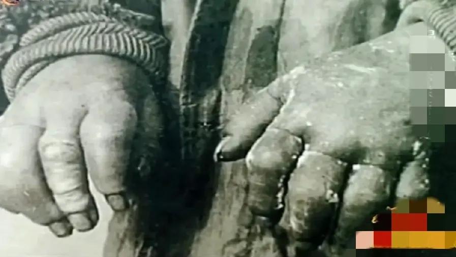 为了战胜苏联，为了让日军士兵更好的适应寒冷天气，731部队开始进行冻伤研究。日军