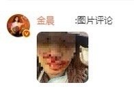 金晨发文道歉说自己助理当时太紧张才说自己是驾驶人并在评论区发了自己受伤严重的图片
