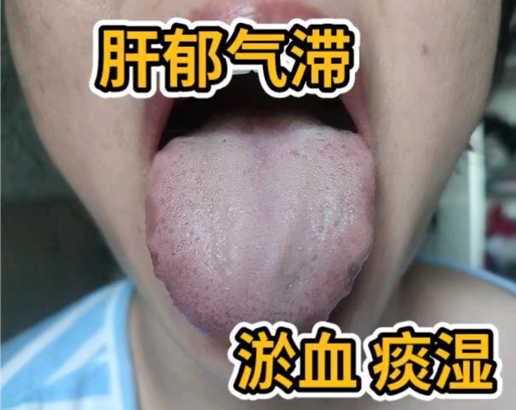 AI扩图 拒绝废话科普冷知识省流 舌苔辨证 湿气重 中医养生