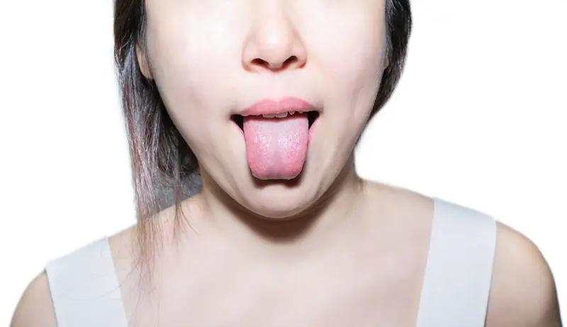 中医看舌头能看出什么病? 中医看舌头那门道可多了。在明亮光线下观察舌象，能发现不