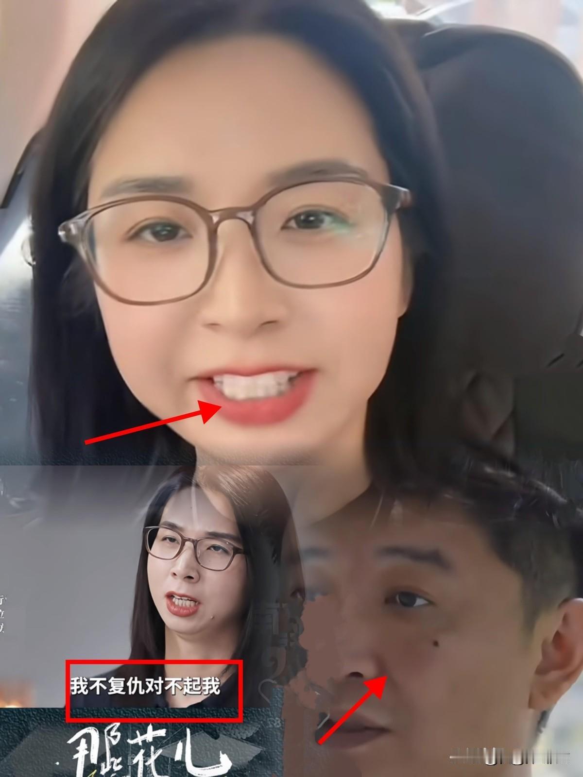 崔丽丽因受伤事件引发关注，但却被网友质疑。有网友表示，她的行为如同“表演”：采访