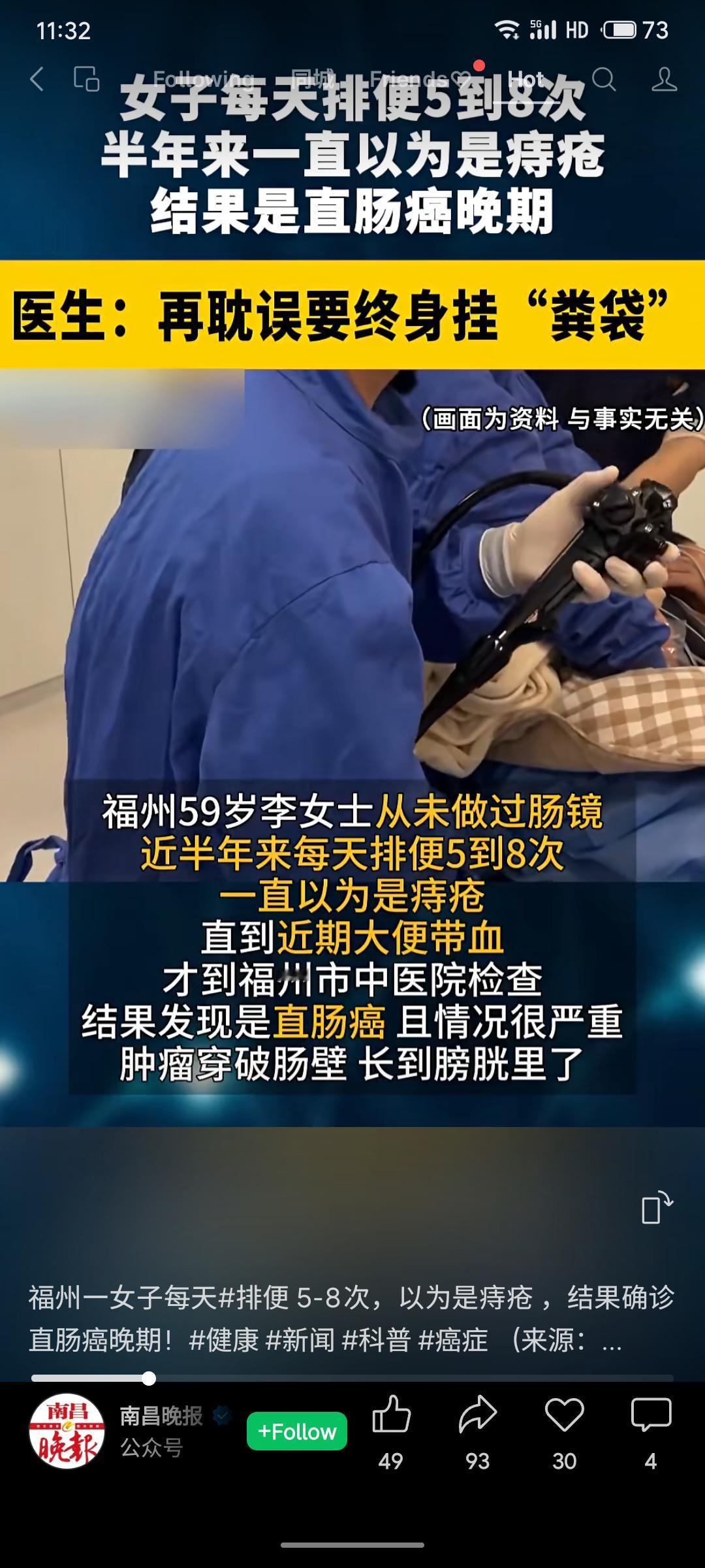 福州59岁李女士半年来每天排便5-8次，自以为是痔疮未重视，直至便血才就医，结果