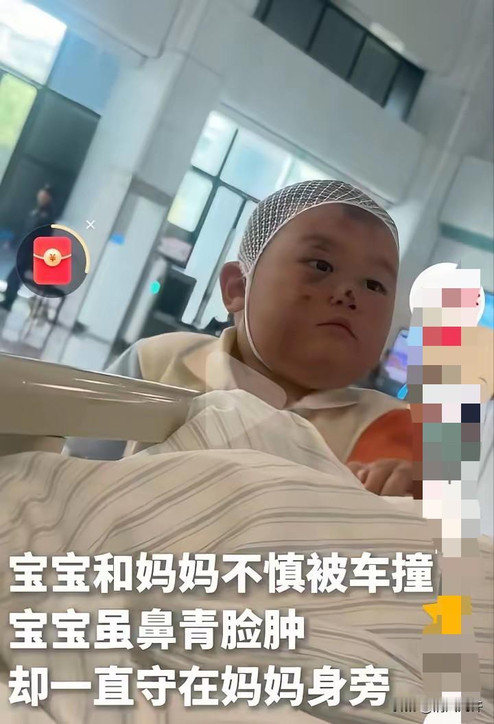 鼻青脸肿的宝宝上人民日报了，明明也受伤了，也很痛，却不哭不闹的跟随着妈妈，眼神坚