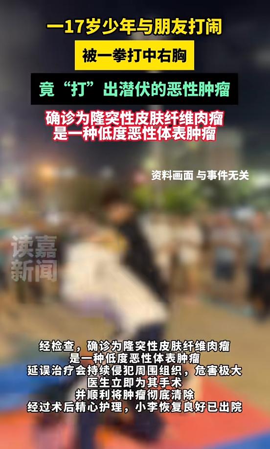 一拳打出来个肿瘤，

说是小病却切了老大一块肉，

它到底算啥玩意儿？

小李今