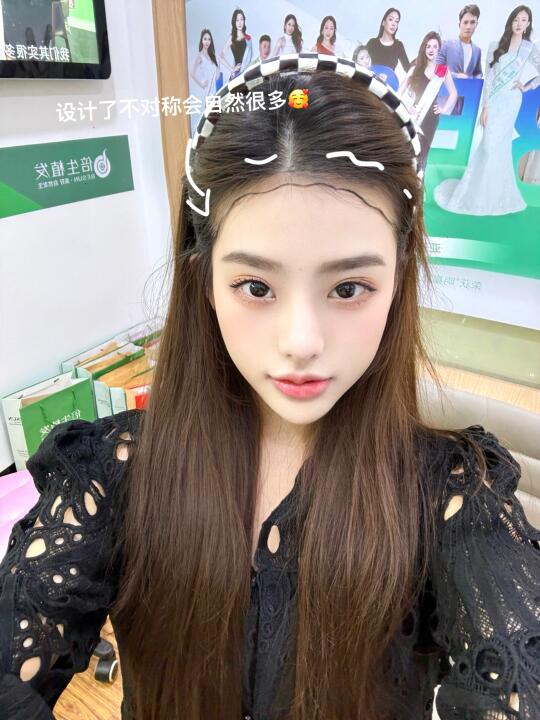 💈2025变美第三步 植发｜摆脱大光明