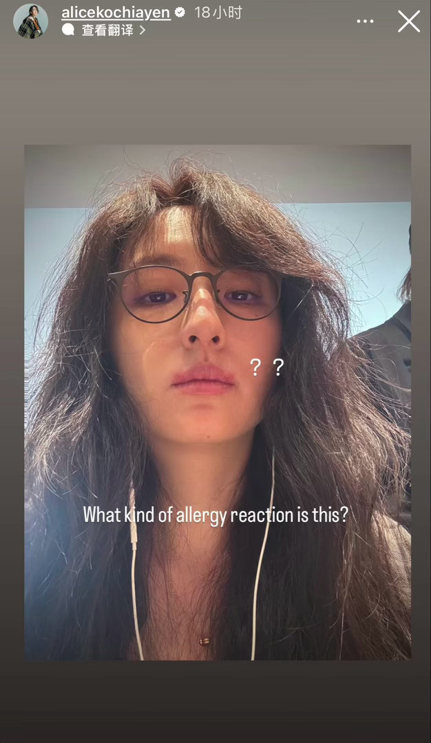 对不起有点好笑，柯佳嬿因为过敏而拥有了许光汉的微笑唇哈哈哈哈 