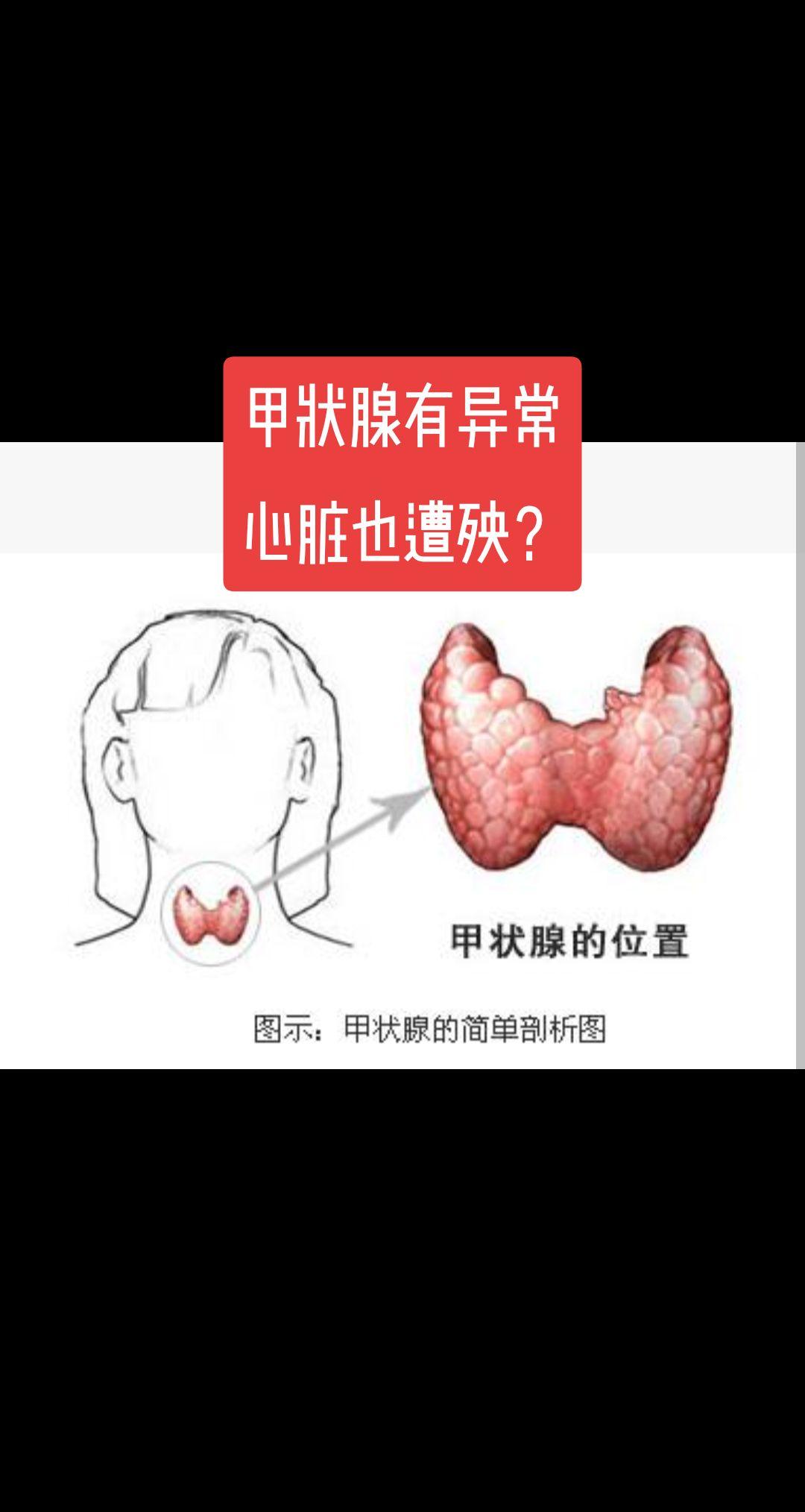 心慌心悸，可能是甲状腺惹的祸。🦋🦋🦋🦋🦋
一些患者经常会有心慌心悸不适，
做心脏方面的检查也发现不了什么原因，
偶尔内科医生会介绍她们看看甲状腺。
确实如此，因为甲状腺功能出了问题，会累及到心脏，不管是甲亢还是甲减，心脏都会受到影响。
比如甲亢，心跳会明显加快，心慌心悸；
而甲减会导致心跳减慢，肢体无力。
甲状腺手术，很可能会影响甲状腺功能，所以，术后定期复查甲状腺功能非常重要，
特别是年龄较大的患者，如果本身有心脏疾病者，更需要共同关注。