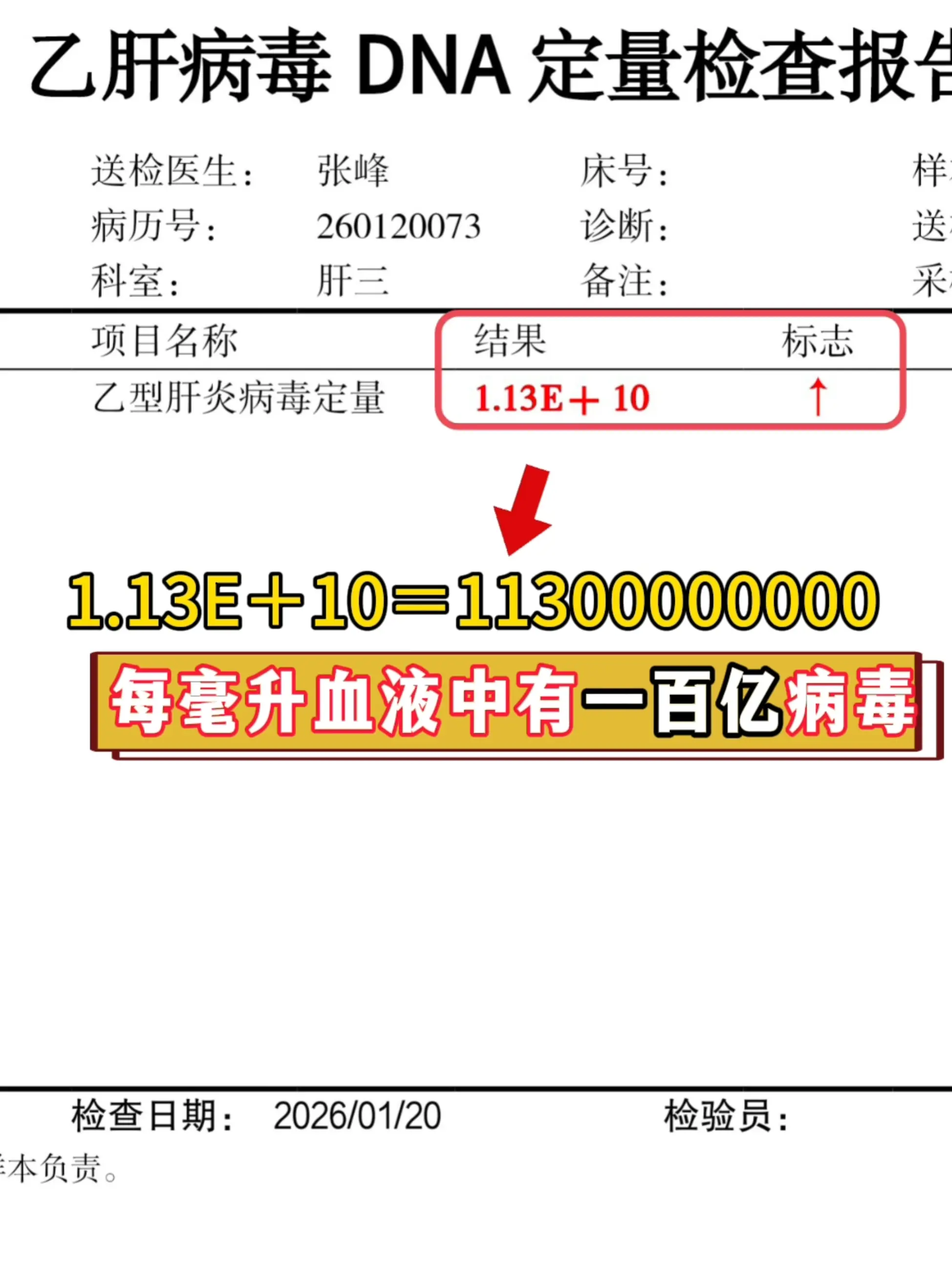这是山东一位朋友，看诊时带过来的化验单，每毫升的血液中足足有100亿的...