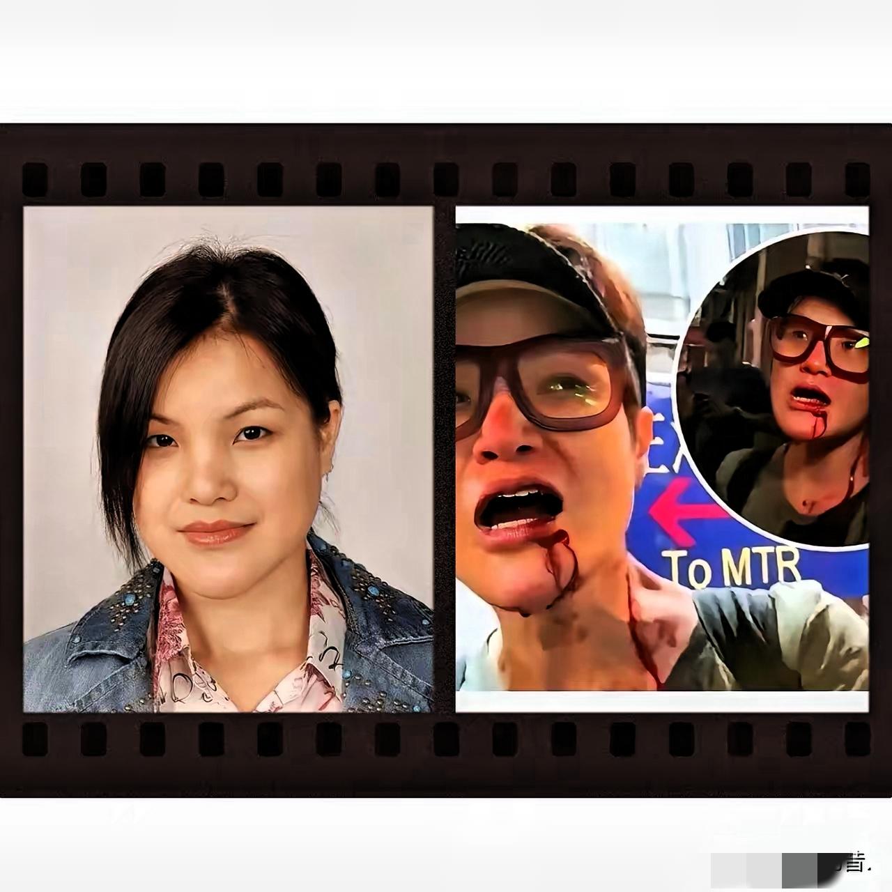 还记得马蹄露当年被黑暴打得头破血流的画面，至今看了都心疼。危难时刻敢站出来守护家