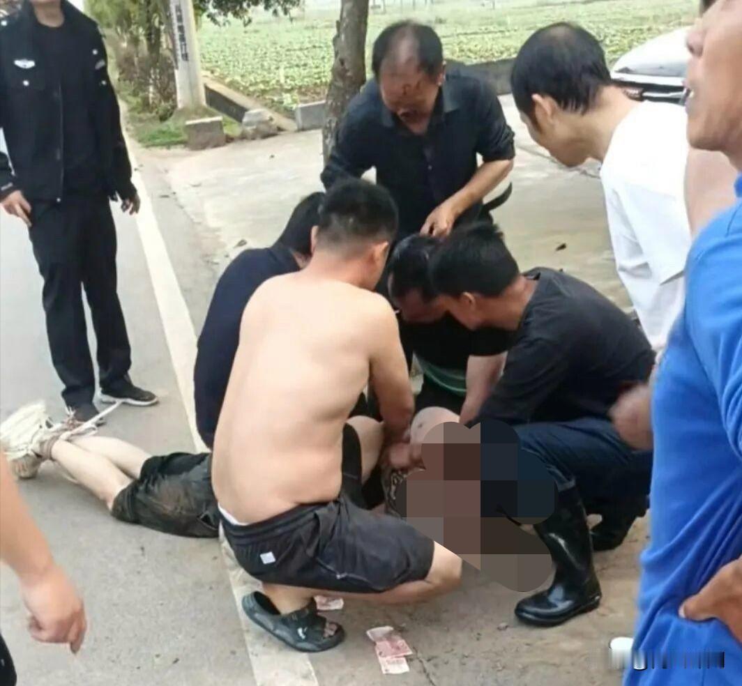 70岁老人救人被咬掉鼻子，这才是真英雄！
 
近日湖南郴州嘉禾，发生一件又吓人又