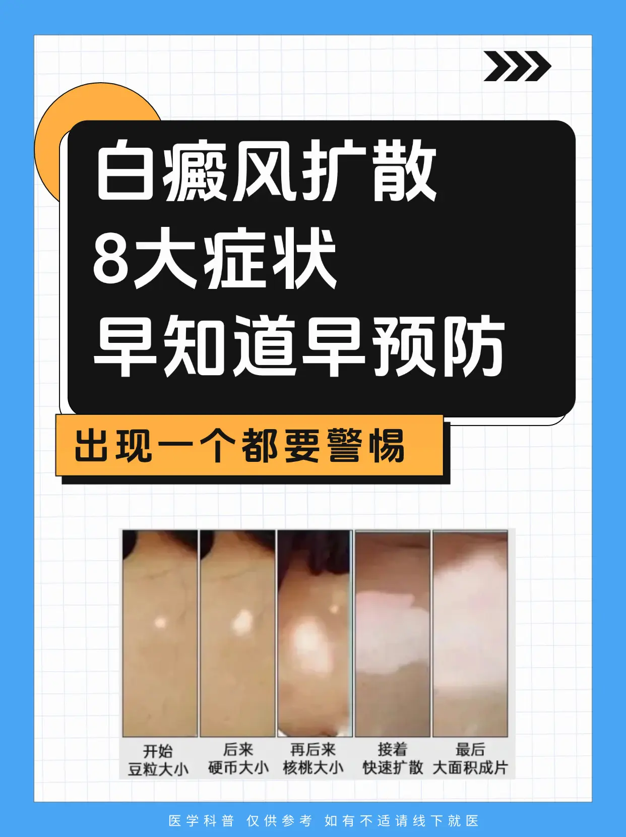 医学科普 白癜风 白癜风科普 白癜风患者 硬核健康科普行动