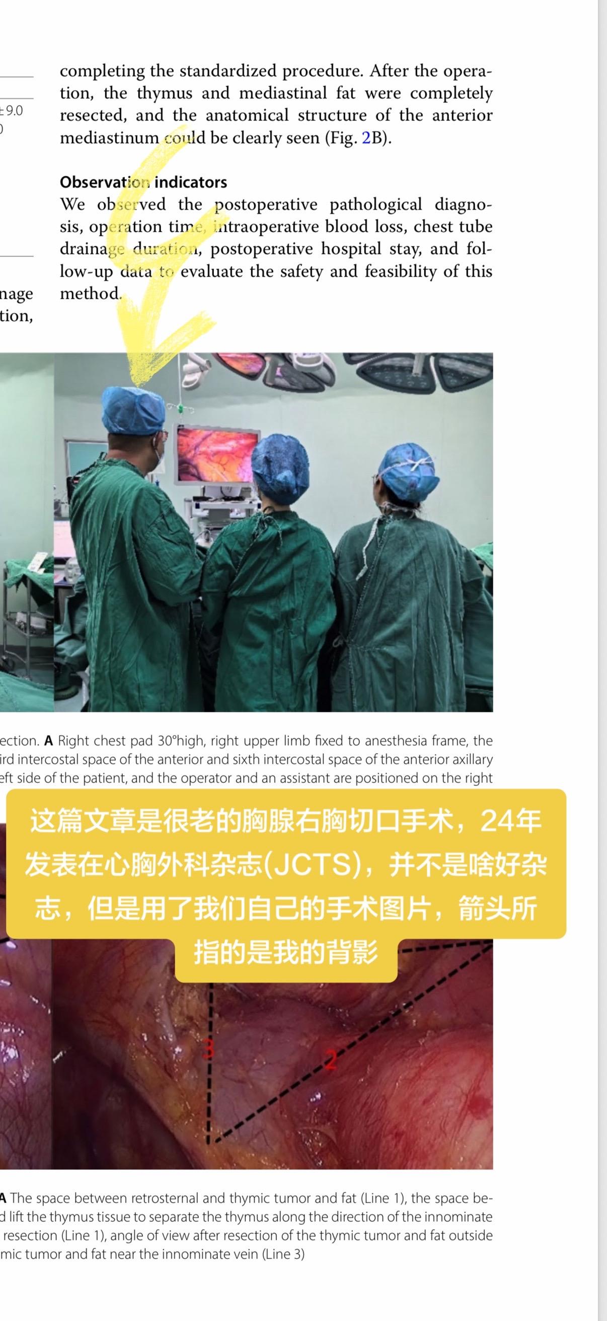 这篇文章是很老的胸腺右胸切口手术，24年发表在心胸外科杂志(JCTS)...