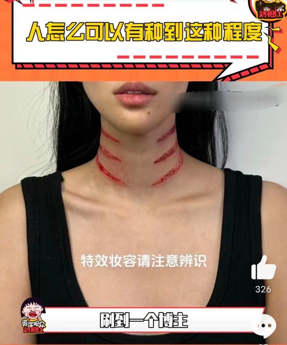 现在都流行夸赞极端自虐式服美役了吗？因为脖子上有疤痕不好看，所以去割掉脖子上的皮