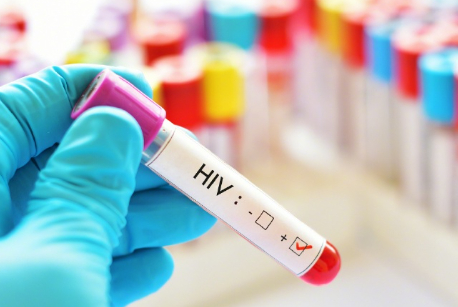 20岁男子感染HIV后HPV反复发作近日一则医疗案例引发关注：20岁患者小林一年