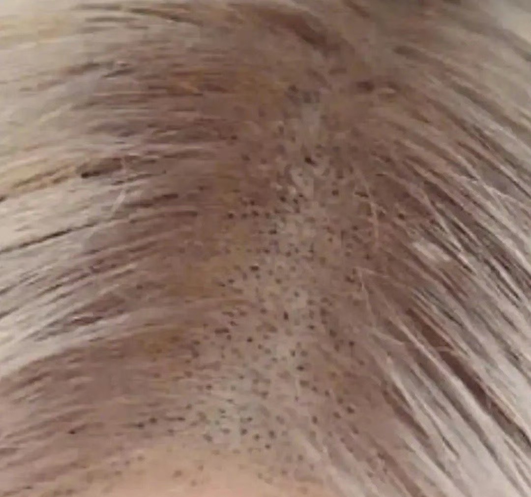 相比张元英还是rose的发缝比较吓人…张元英发缝