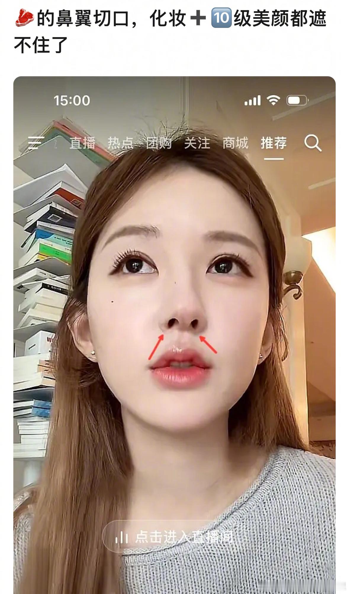 赵露思的鼻子被说全是医美痕迹，来审判下 ​​​