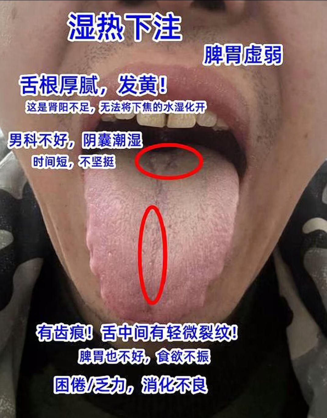粉丝朋友的舌象分享 看看你是哪种