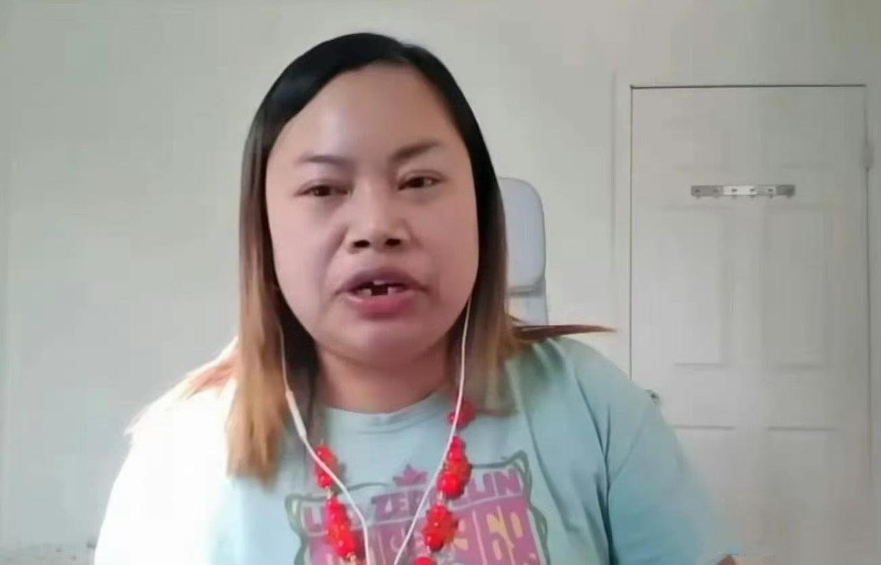 得什么病会掉牙齿呢？凤姐和韦神症状一致，健康状态堪忧！

韦神和凤姐就是现实版的