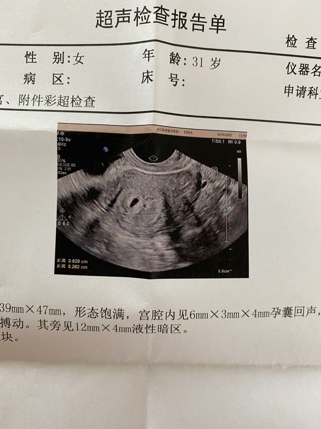 当初决定要宝宝后，我都经历了哪些？