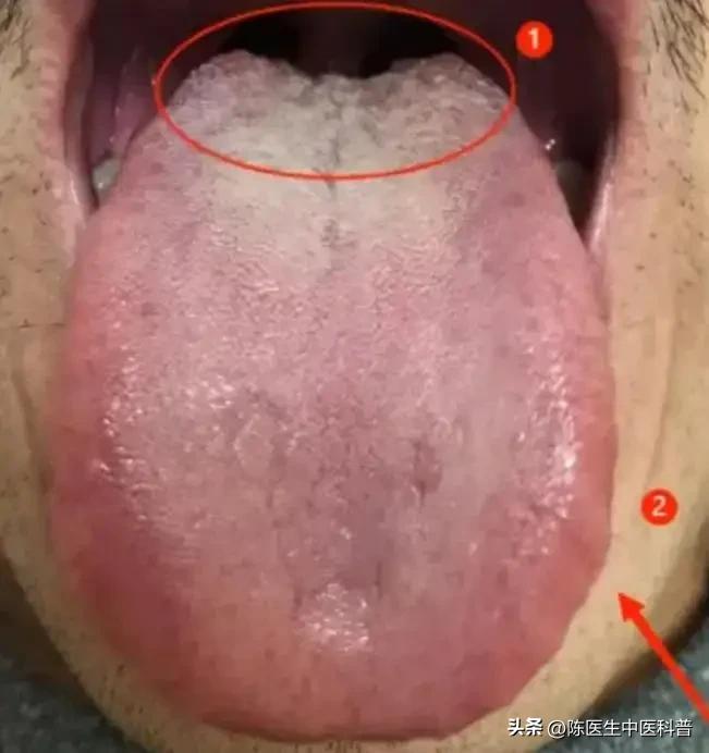 一舌五病！肝郁、脾虚、肾虚全占？这个小方帮你一站式调理
 
大家好，我是陈大夫！