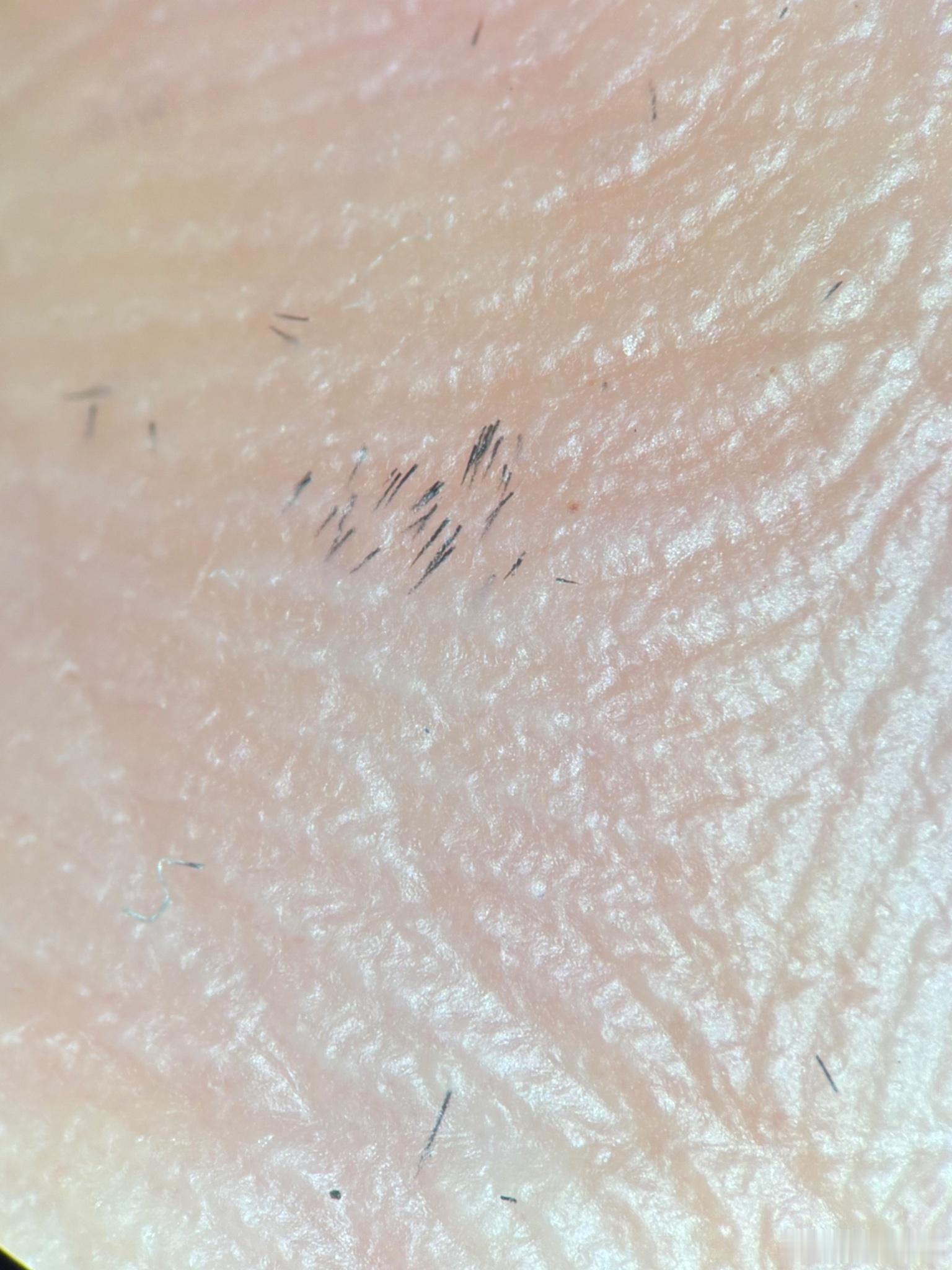 穿过灌木丛后手一直疼，仔细一看，刺入了刺？用显微镜看了看，这个大小。 