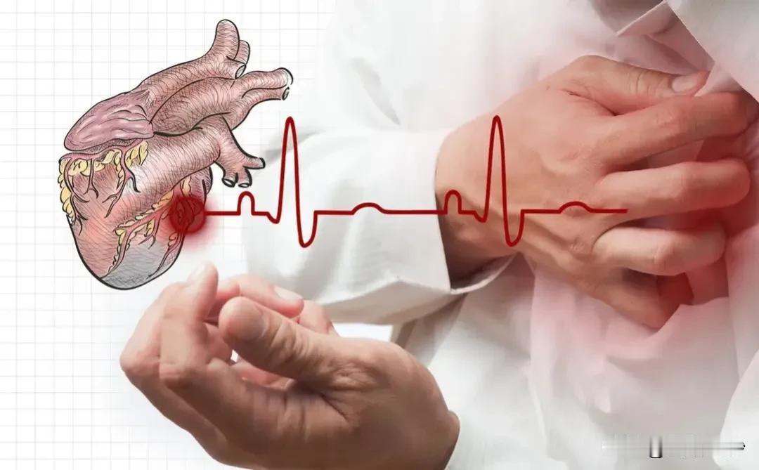 治疗冠心病的中成药和西药汇总！

冠心病是一种常见的心血管疾病，它是由于冠状动脉