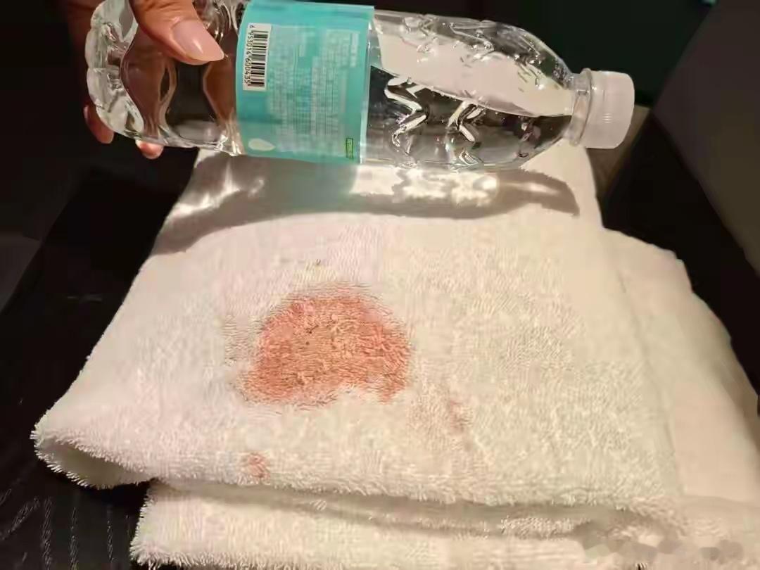男子发现酒店浴巾有大片血迹，担心染病要求赔偿，酒店回应：血迹非常新鲜，怀疑想敲诈