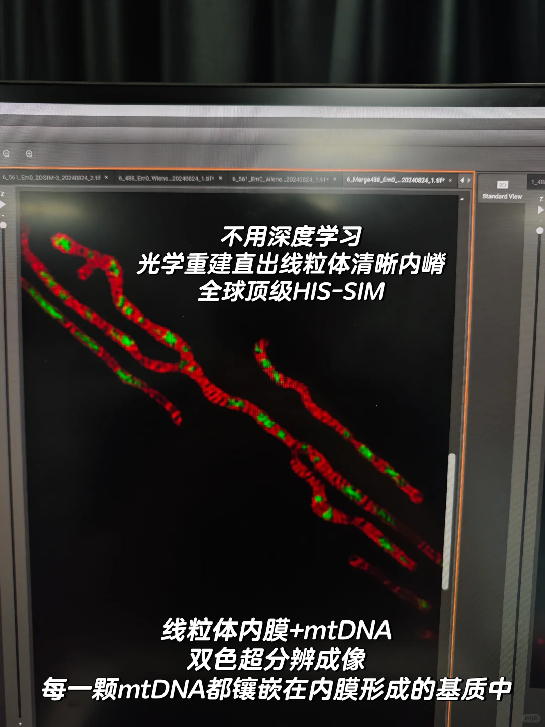 线粒体与mtDNA，拍到啦！