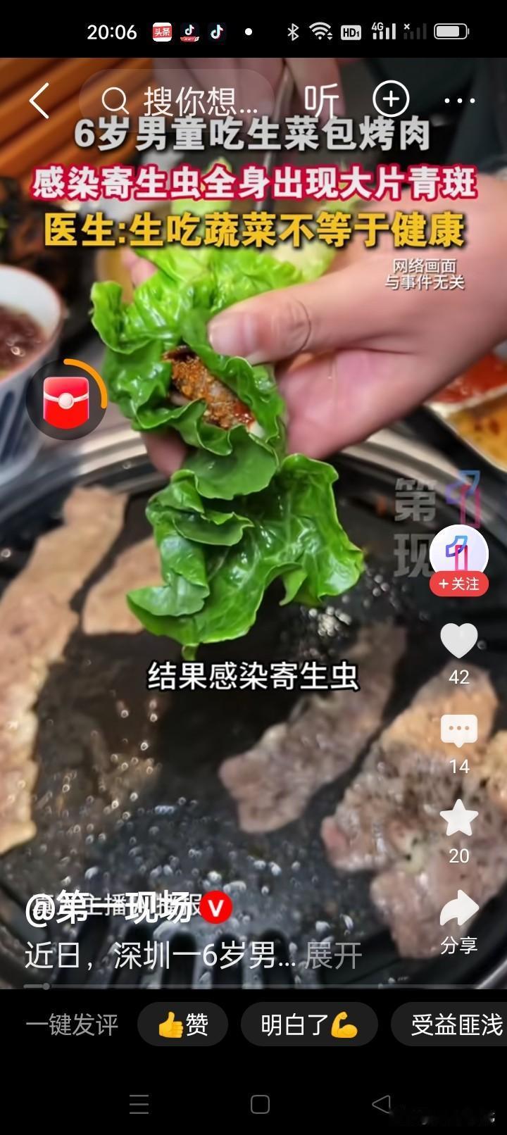 深圳一个6岁男童吃了生菜包烤肉，没几天全身长满青斑血肿，家长以为是白血病，吓得崩