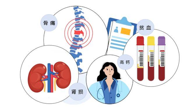 多发性骨髓瘤的发病原因是什么？

多发性骨髓瘤可能由遗传因素、电离辐射、慢性抗原